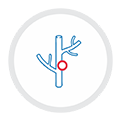 border-vascular_0001_deep-vein-thrombosis vascular surgery Deep Vein Thrombosis DVT